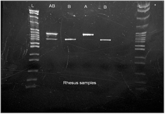 ABO Phenotyping